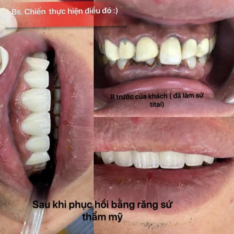 Nha Khoa Hà Nội
