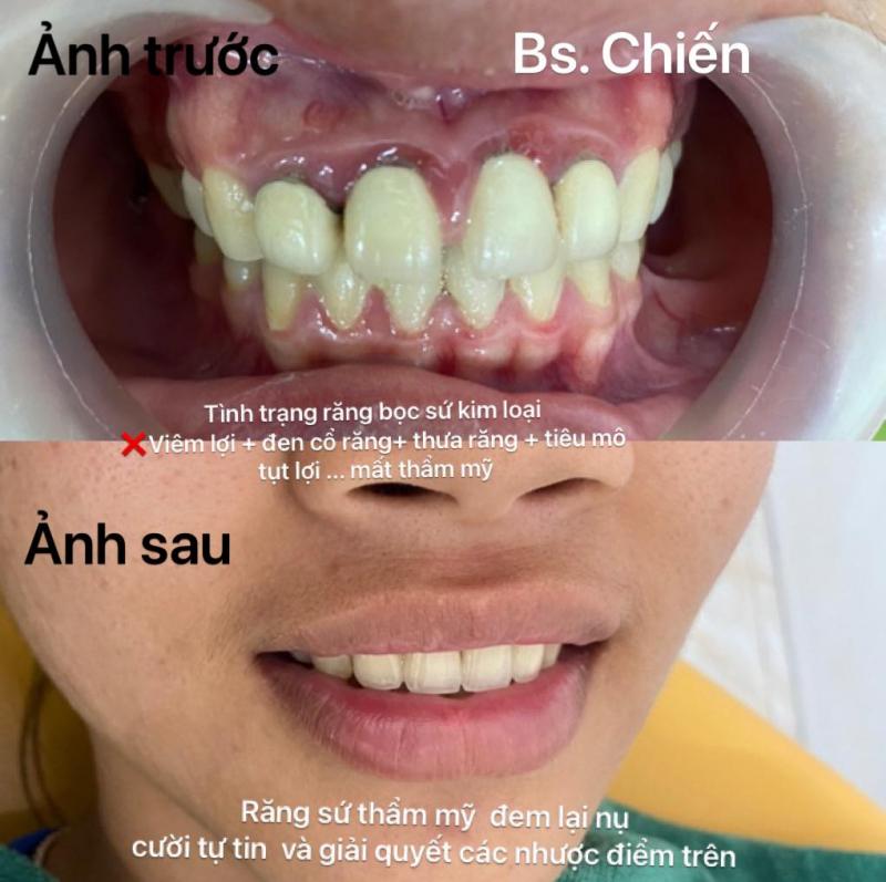 Nha Khoa Hà Nội