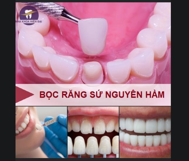 Nha Khoa Hiện Đại