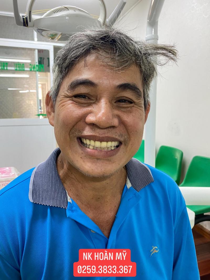 Nha Khoa Hoàn Mỹ