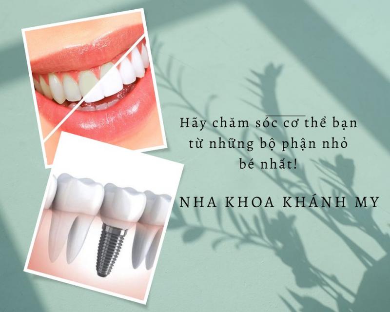 Nha Khoa Khánh My