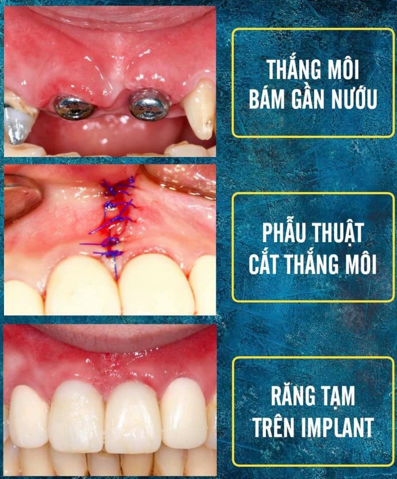 Nha khoa Kim Cương