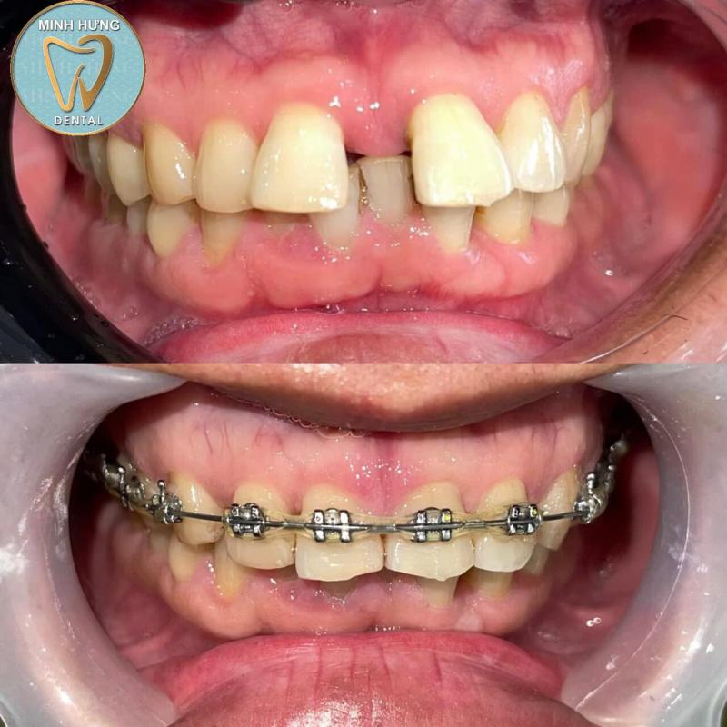 Nha khoa Minh Hưng - Hà Nam Dental