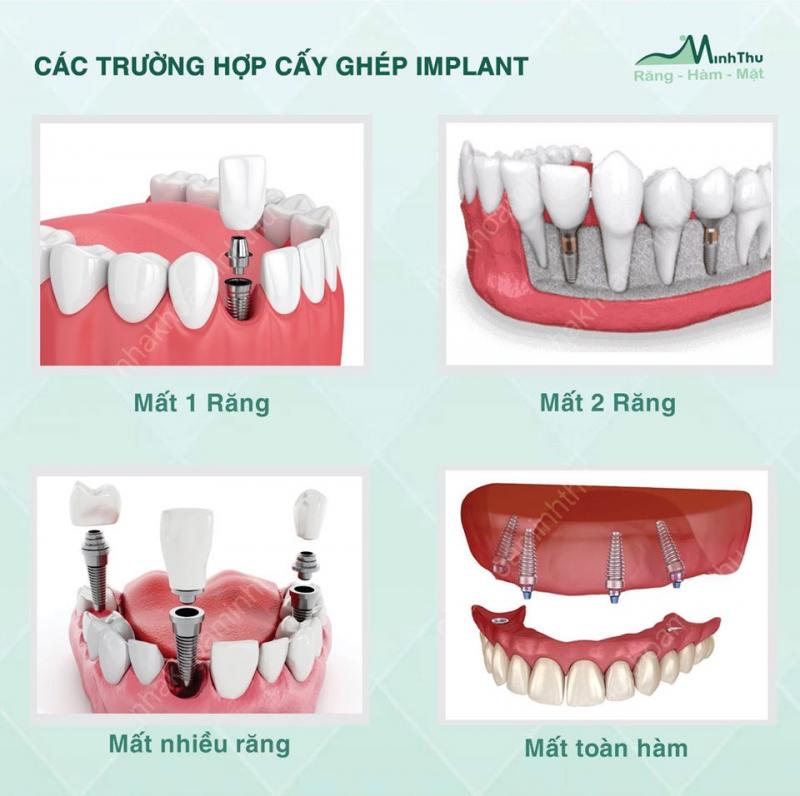 Nha Khoa Minh Thu