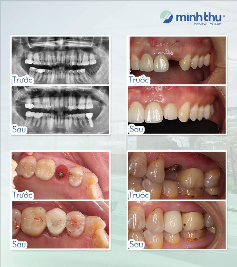 Nha khoa Minh Thu – Hơn 35 năm lời khẳng định bền vững