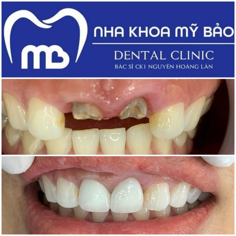 Nha Khoa Mỹ Bảo
