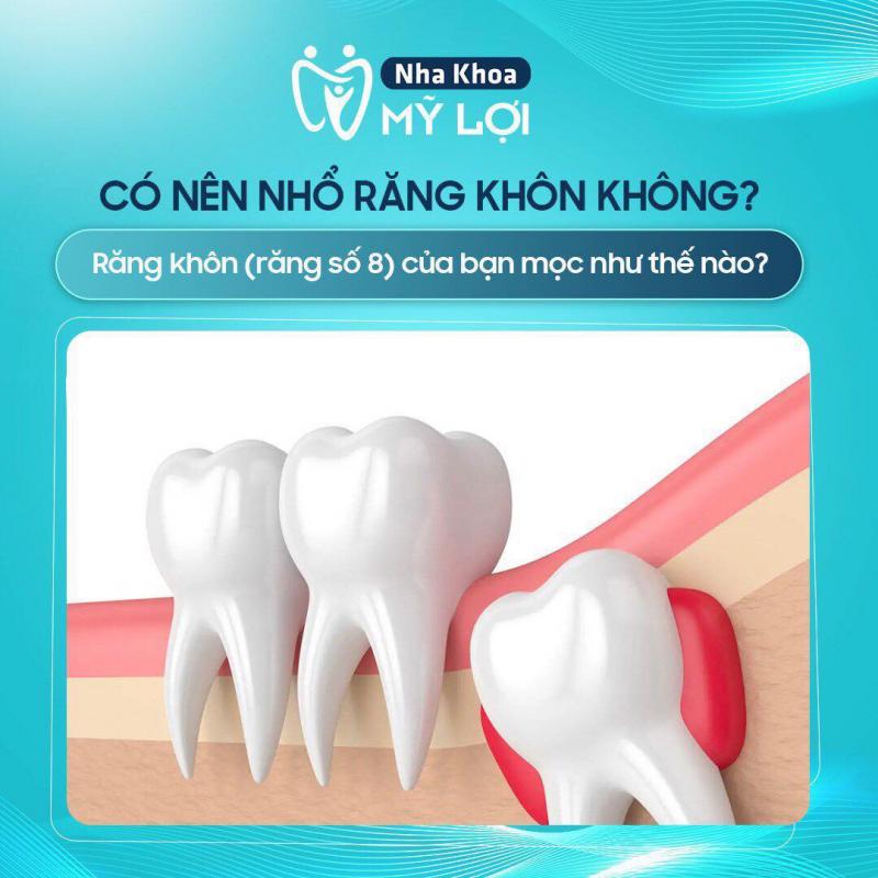 Nha Khoa Mỹ Lợi