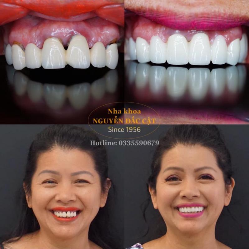Nha khoa Nguyễn Đắc Cật