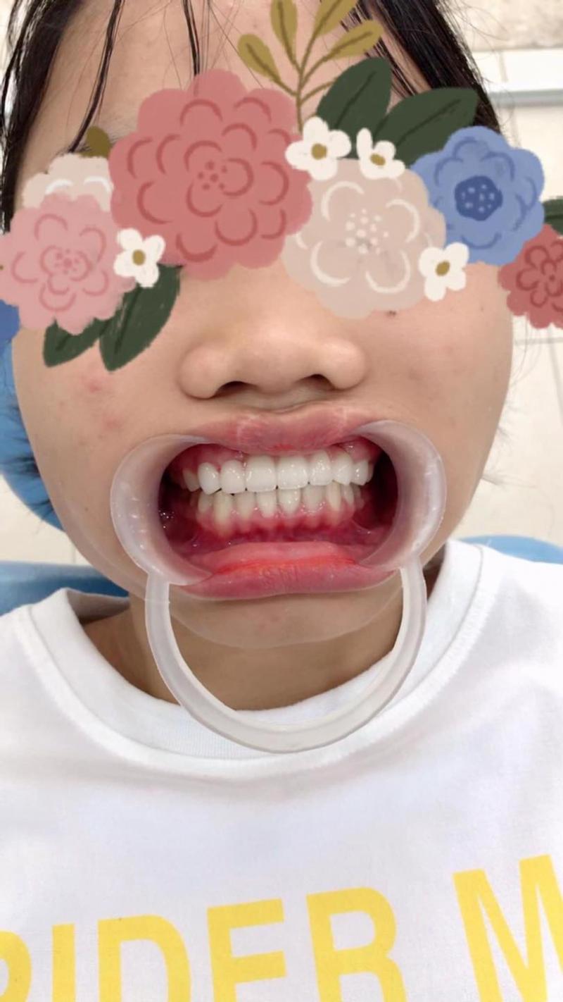 Nha Khoa Nha Nhân