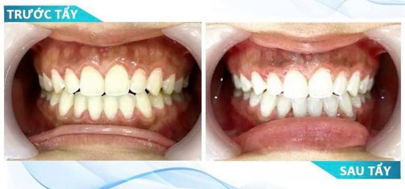 Nha khoa Nụ Cười Cà Mau