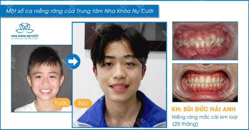 Nha khoa Nụ Cười