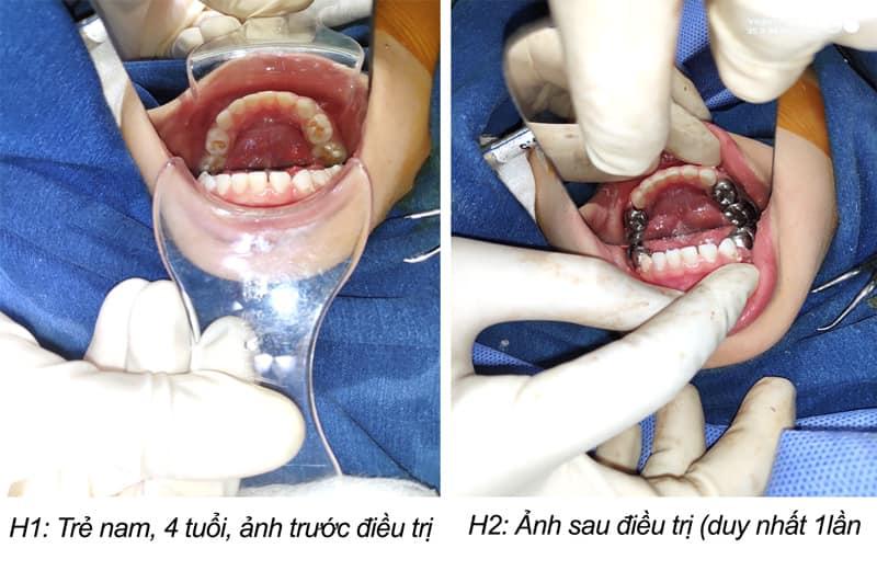 Nha Khoa Nụ Cười Sài Gòn