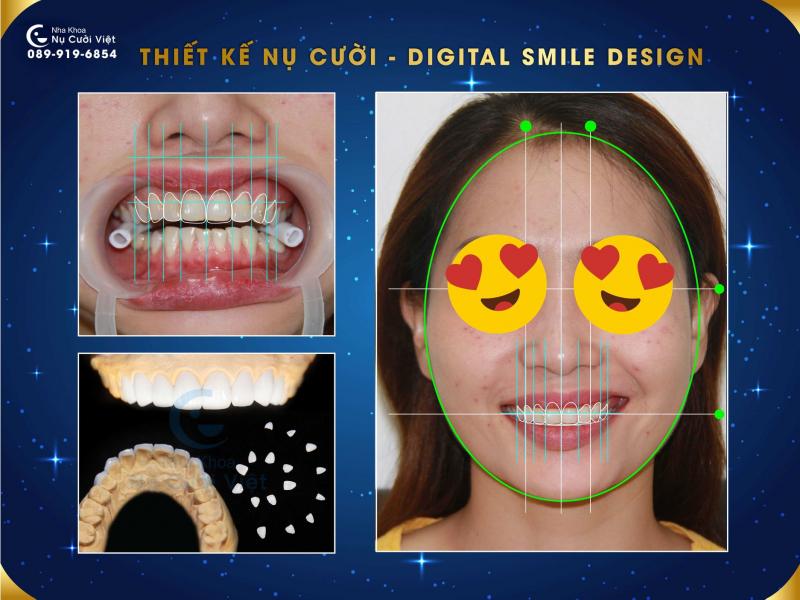 Nha khoa Nụ Cười Việt