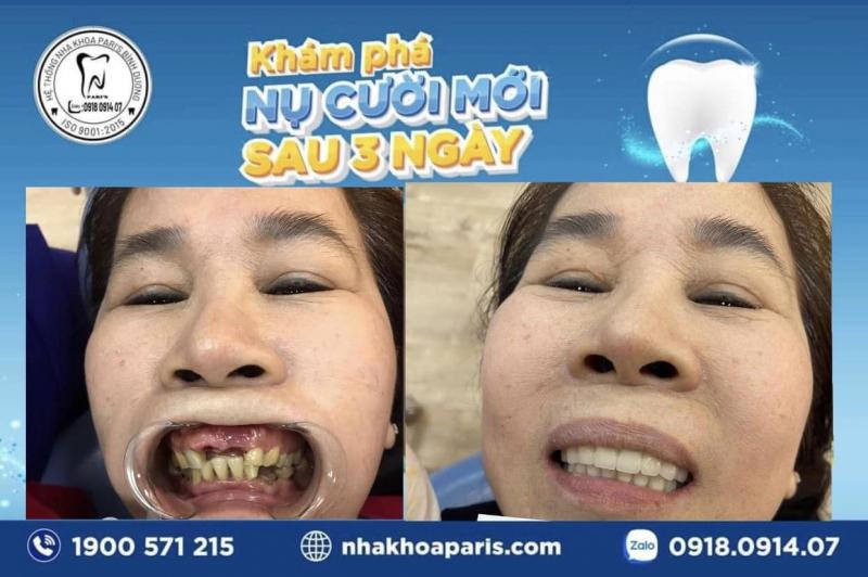 Nha khoa Pari’s