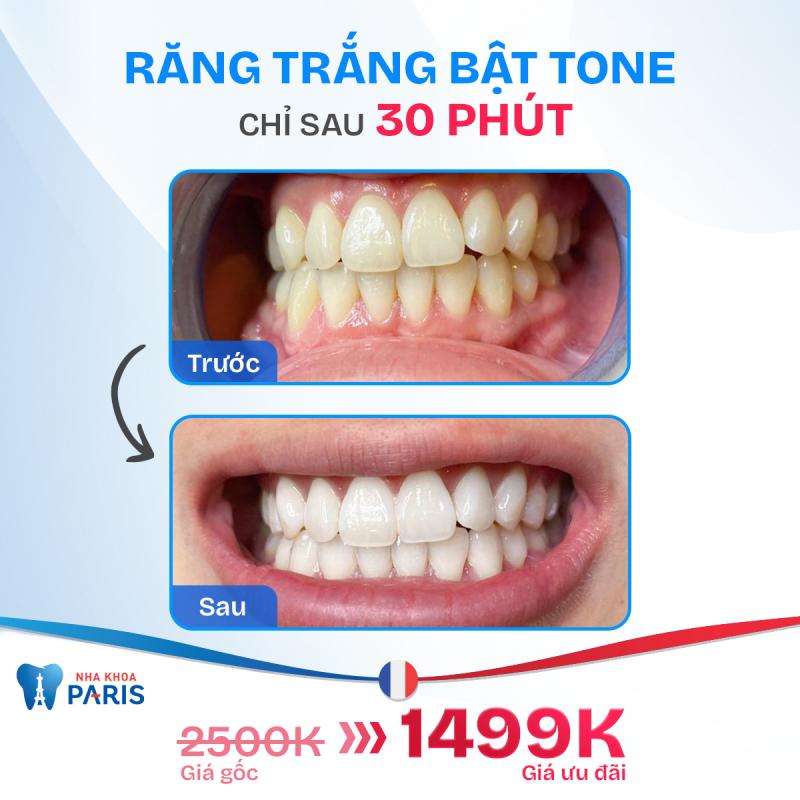 Nha Khoa Paris Hải Phòng
