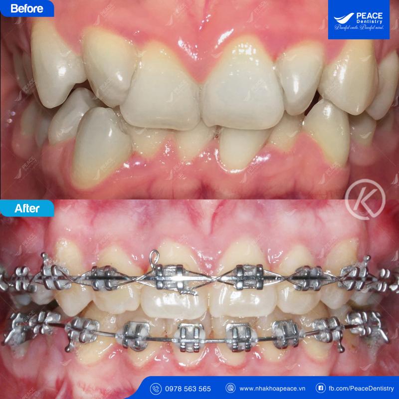Peace Dentistry