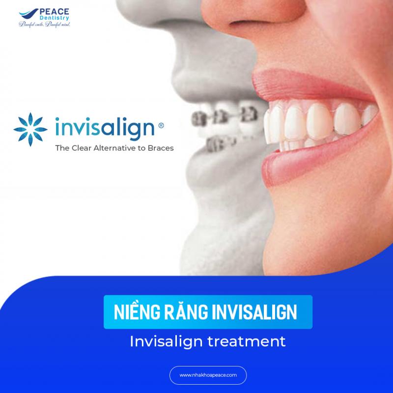 NHA KHOA PEACE DENTISTRY