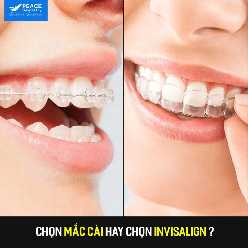 NHA KHOA PEACE DENTISTRY