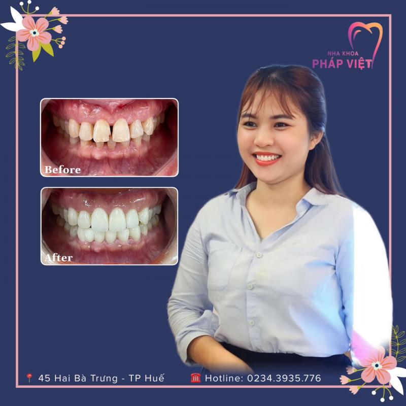 Nha khoa Pháp Việt