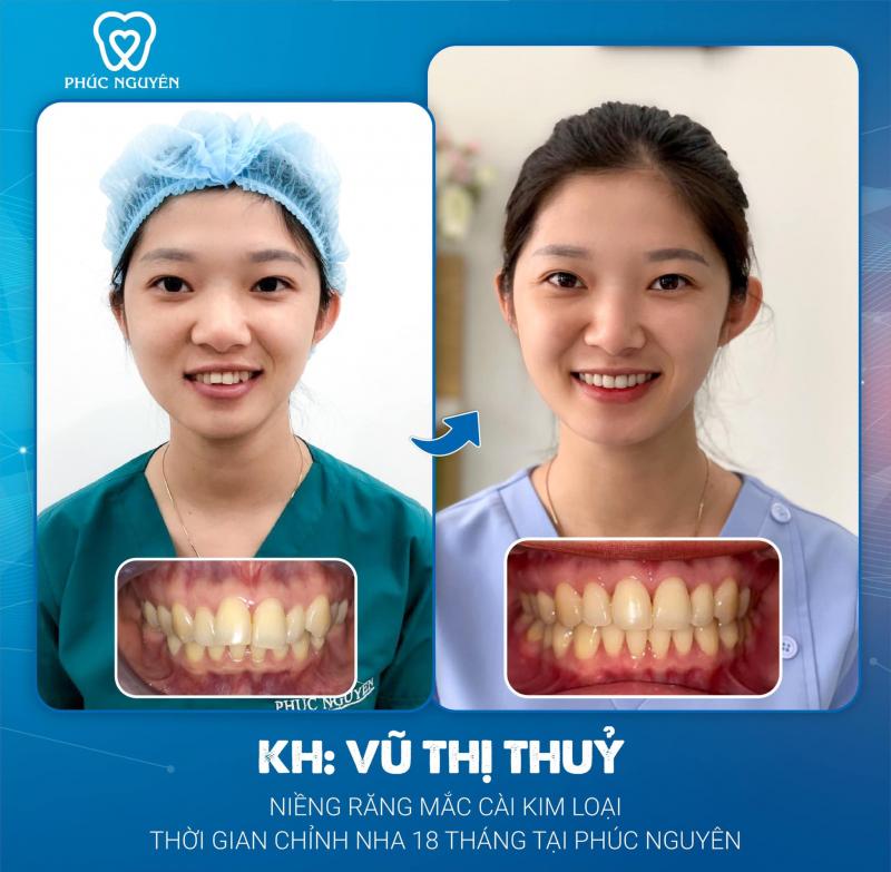 Nha khoa Phúc Nguyên