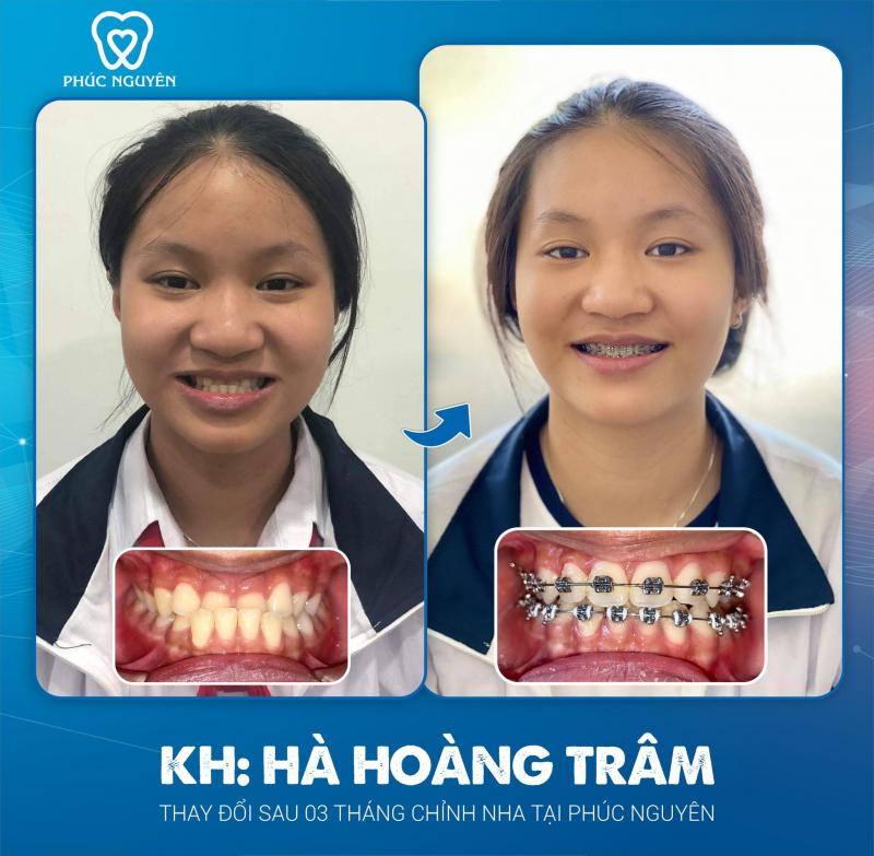 Nha khoa Phúc Nguyên