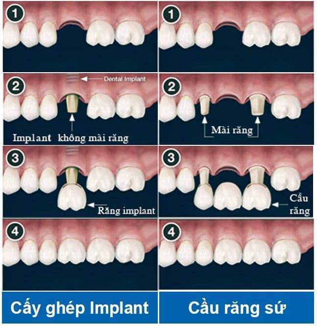 Nha Khoa Quốc Tế Á Đông