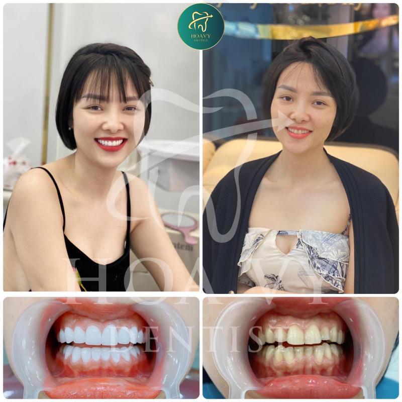 Nha khoa Quốc tế Hoa Vy