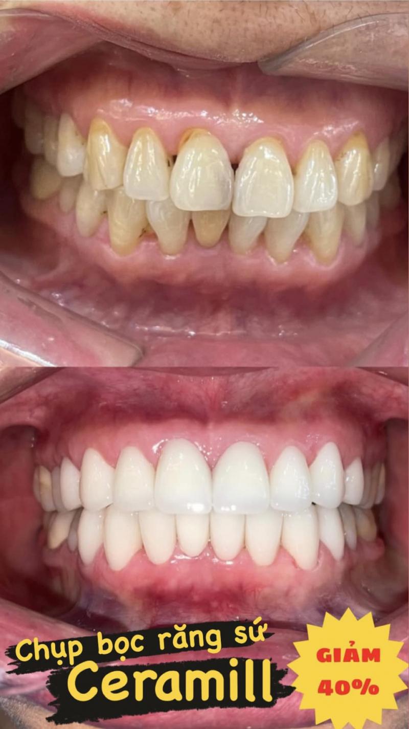 Nha Khoa Quốc Tế Tâm Đức