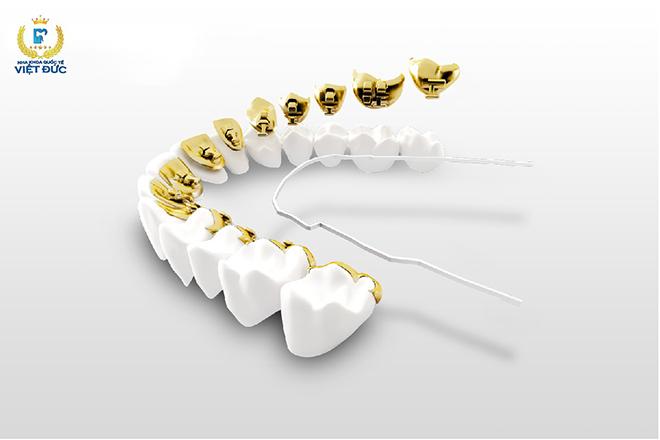 Nha khoa Quốc tế Việt Đức