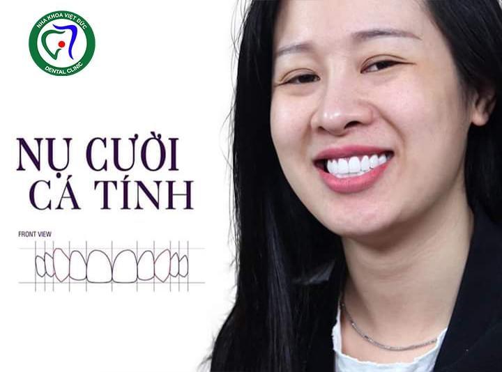 NHA KHOA QUỐC TẾ VIỆT ĐỨC