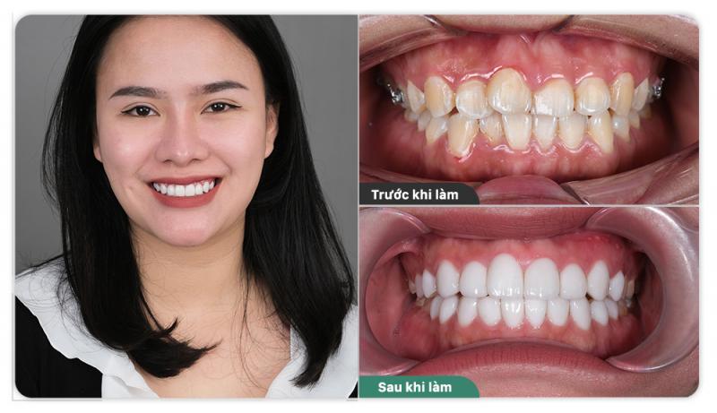 Nha khoa Việt Mỹ