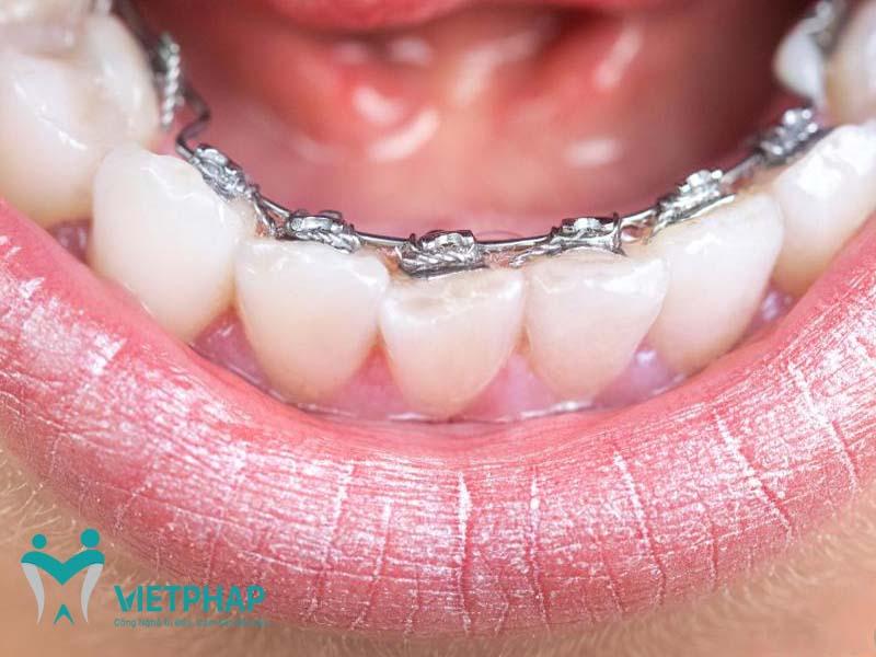 Nha khoa Quốc tế Việt Pháp