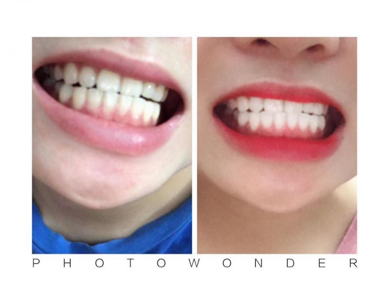 Nha Khoa Quốc Tế Việt Pháp