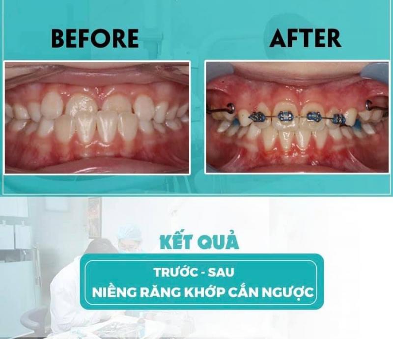 Nha Khoa Quốc Tế VIệt Pháp