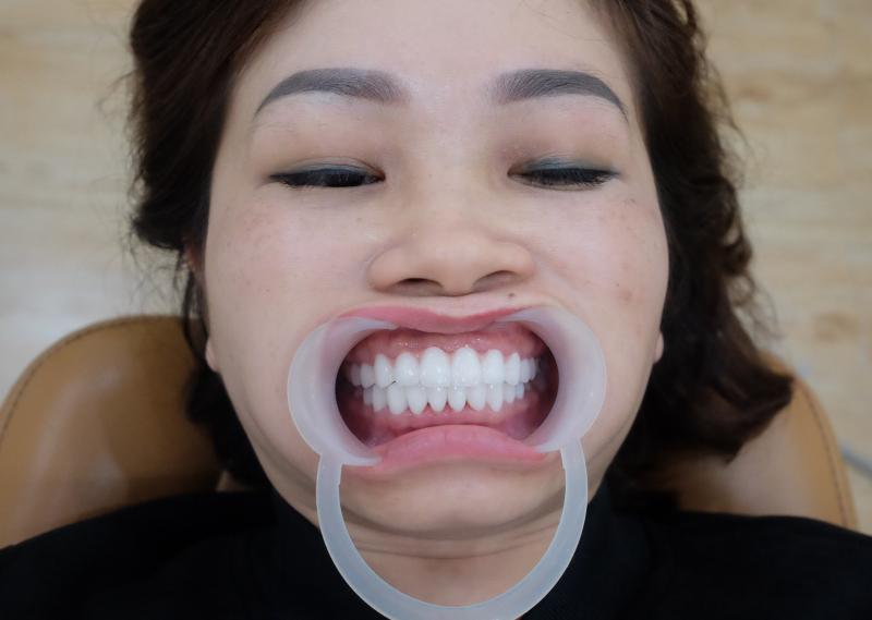 Nha Khoa Quốc Tế Việt Pháp