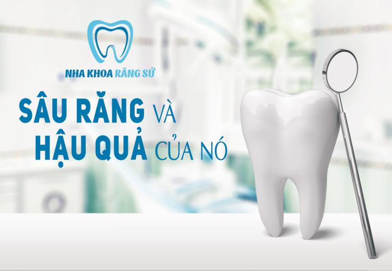 Nha khoa Răng Sứ