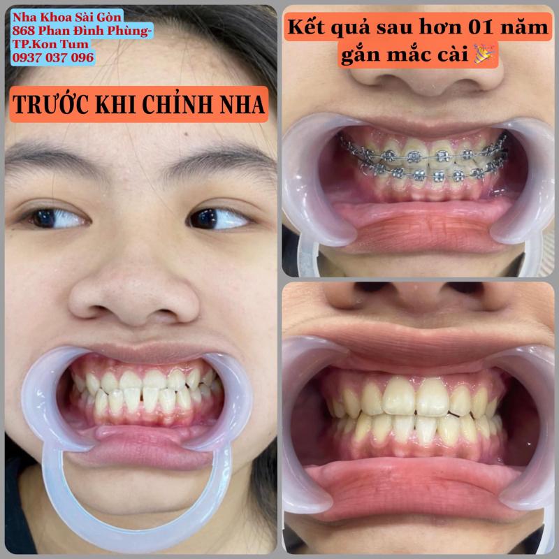Nha khoa Sài Gòn