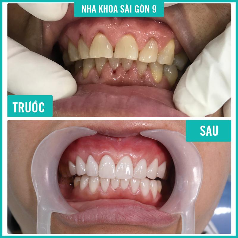 Nha Khoa Sài Gòn