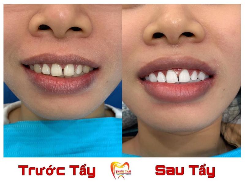 Nha khoa Thiện Tâm