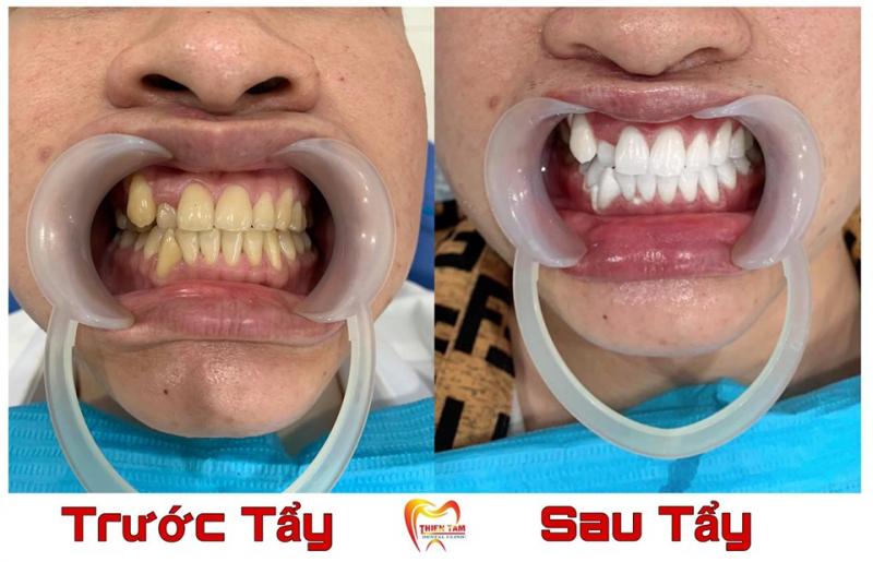 Nha khoa Thiện Tâm
