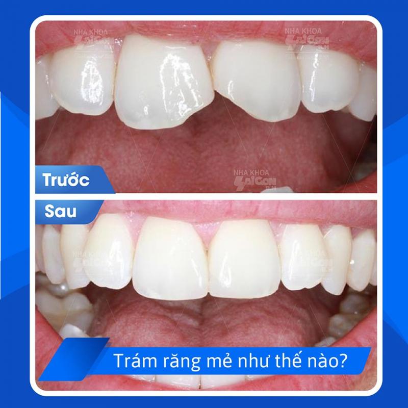 Nha khoa Sài Gòn B.H