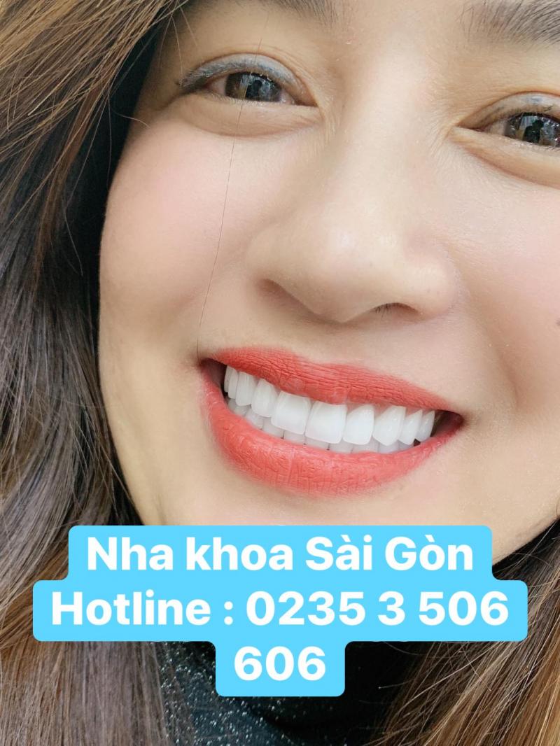 Nha khoa Sài Gòn Duy Xuyên