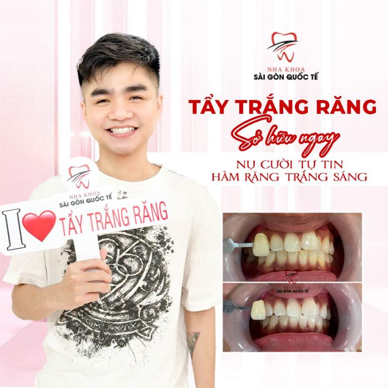 Nha Khoa Sài Gòn Quốc Tế Phú Quốc