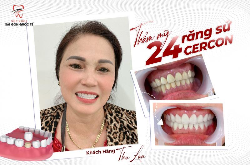 Nha Khoa Sài Gòn Quốc Tế Phú Quốc