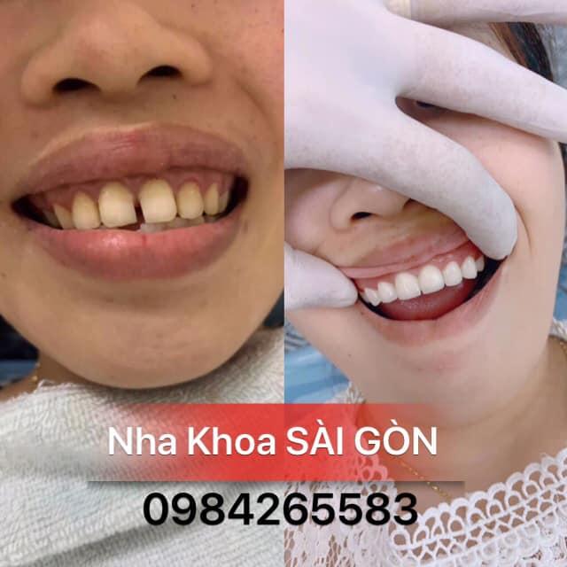 Nha Khoa Sài Gòn Thanh Hoá