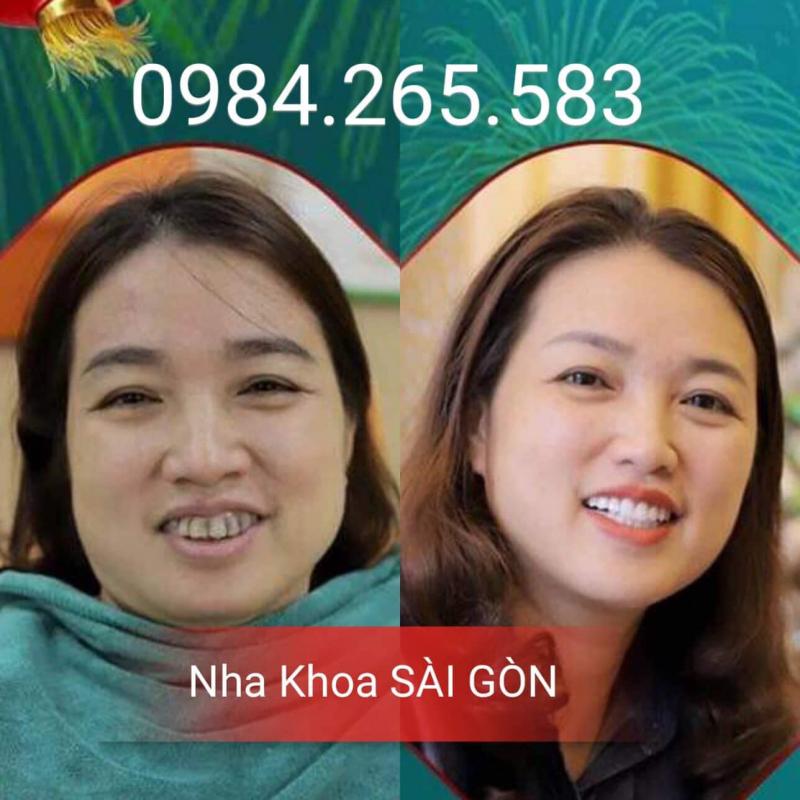 Nha Khoa Sài Gòn Thanh Hoá