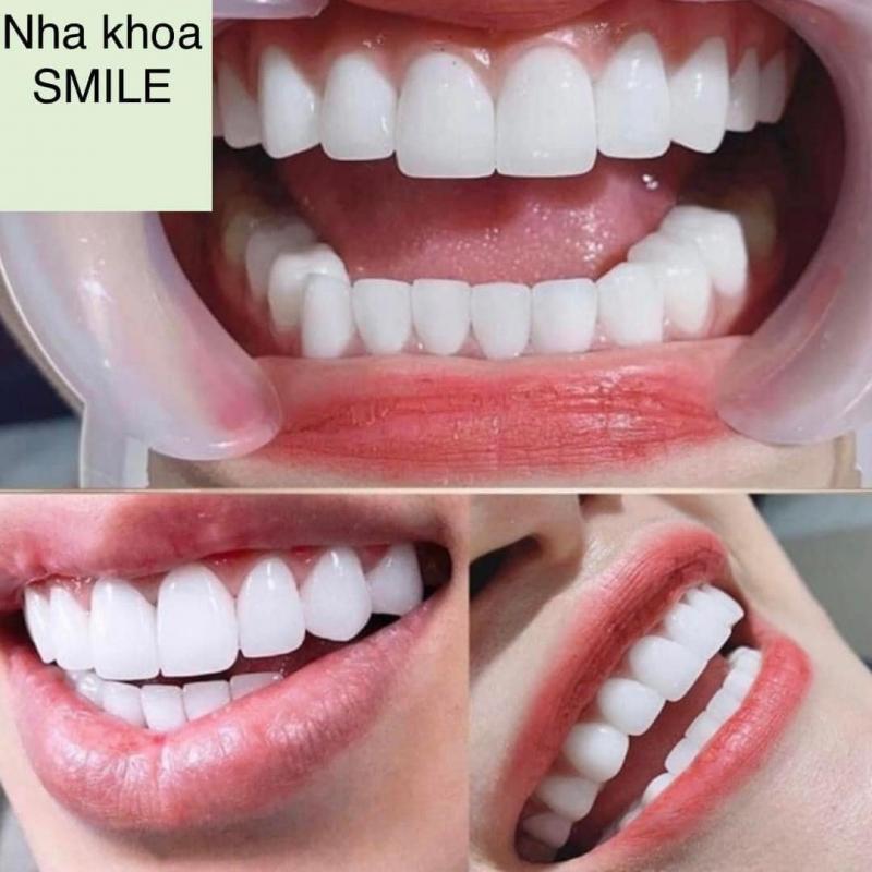 Nha Khoa Smile