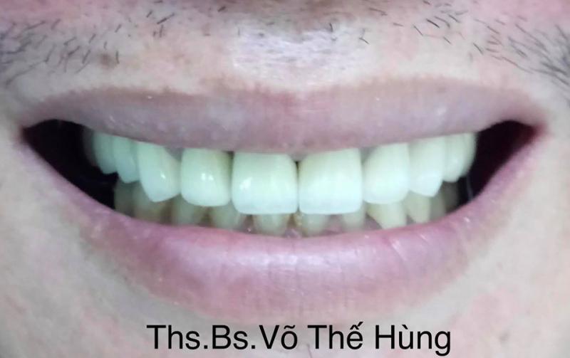 Nha Khoa Smile Tam Kỳ