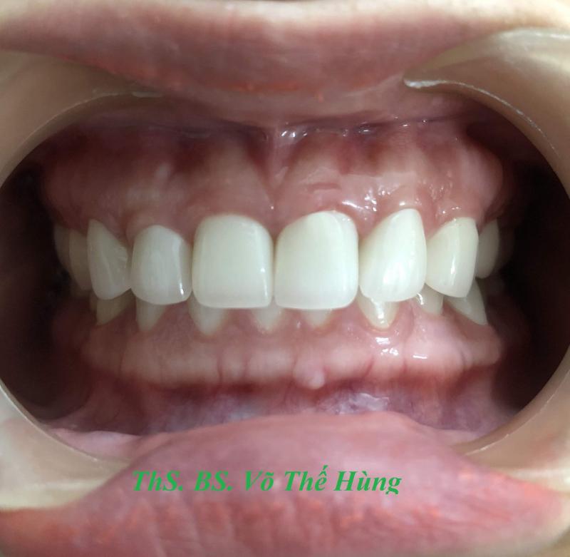 Nha Khoa Smile Tam Kỳ