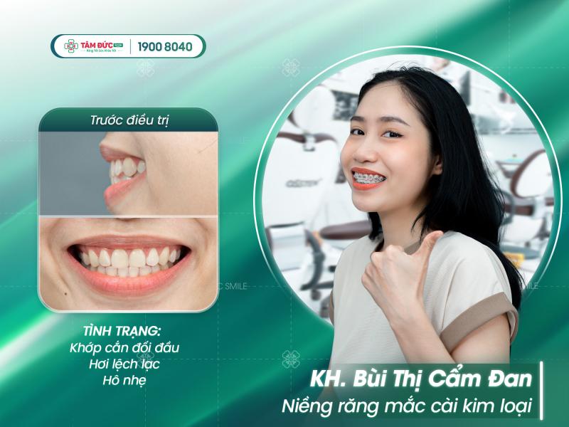Nha Khoa Tâm Đức Smile